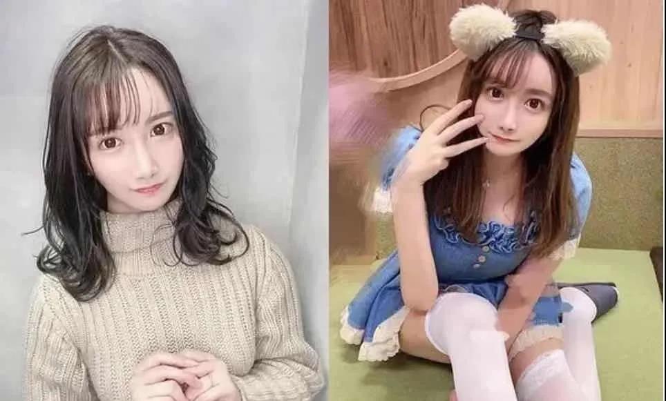 双眼皮手术