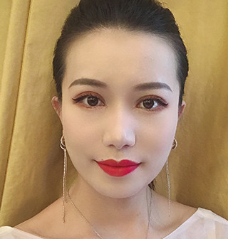 双眼皮手术