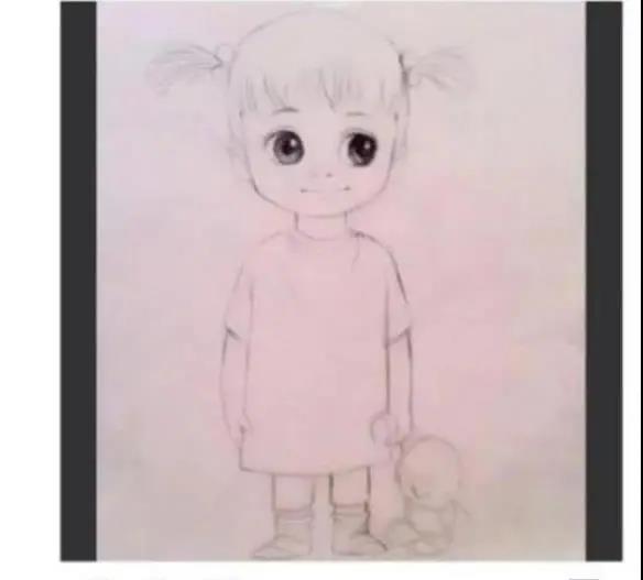 双眼皮手术