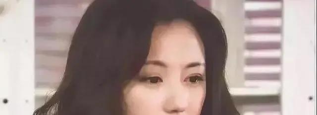 双眼皮手术