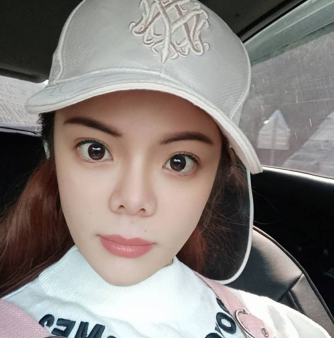 长效玻尿酸