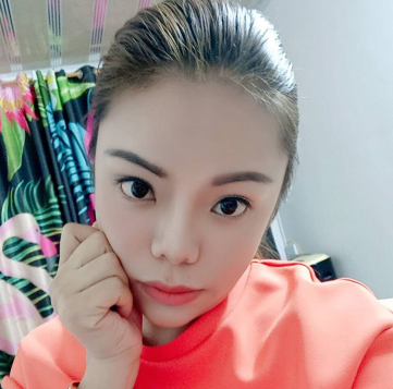长效玻尿酸