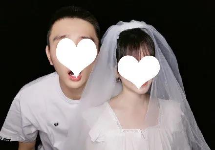 面部提升术