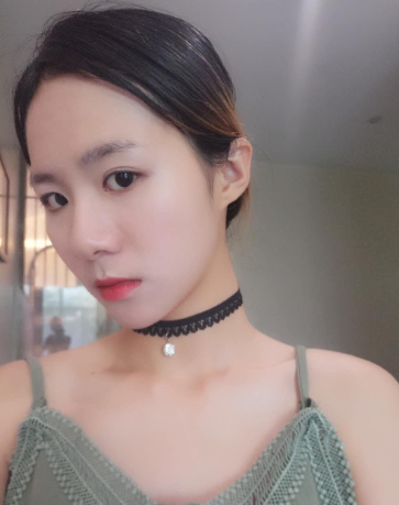 面部提升术