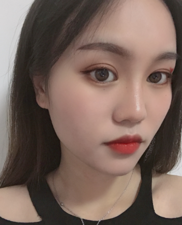 双眼皮手术