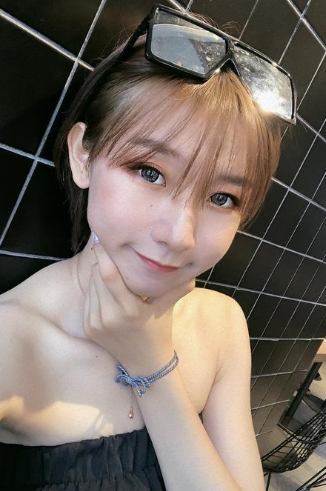 双眼皮手术