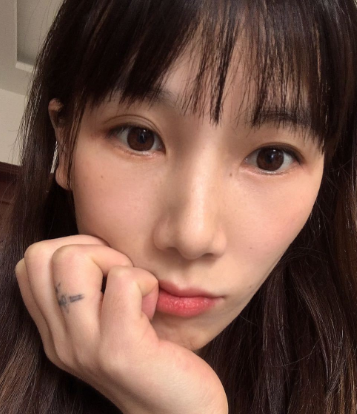 去眼袋手术
