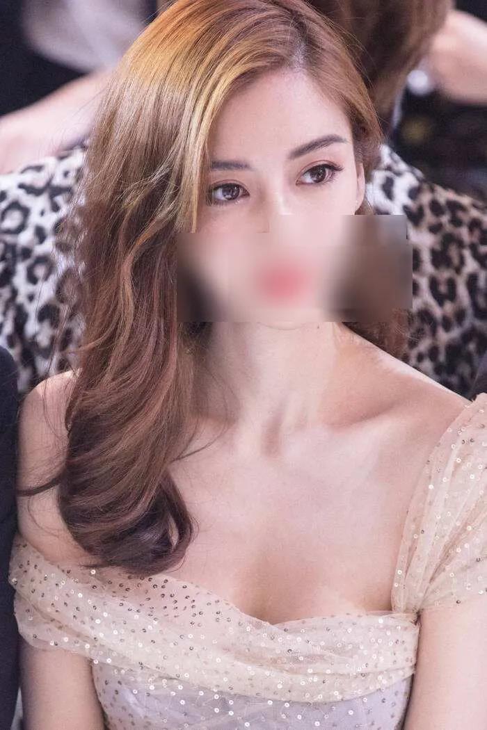 隆鼻手术