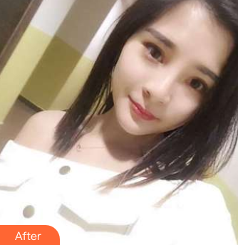 长效玻尿酸