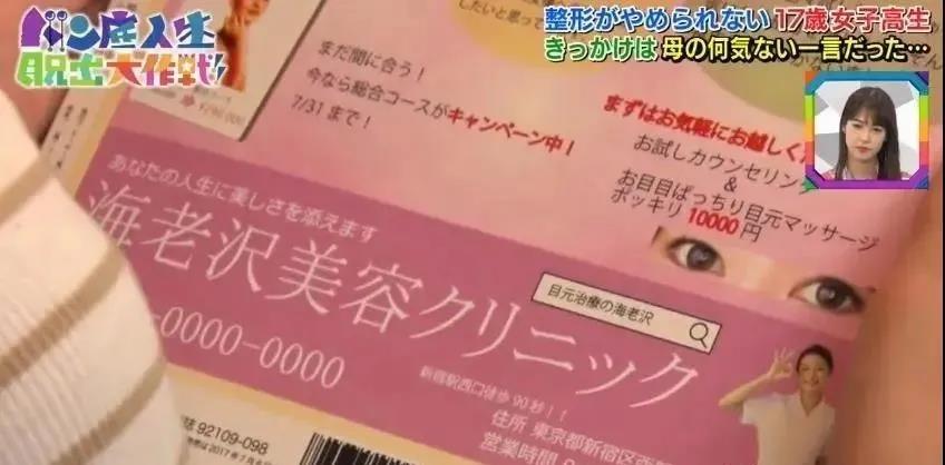 双眼皮手术