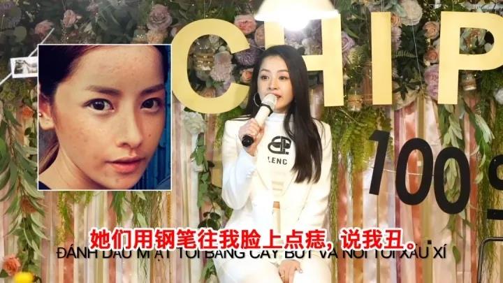 超皮秒祛斑