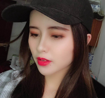长效玻尿酸