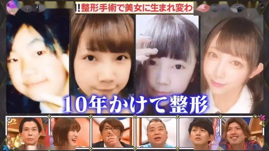 去眼袋手术