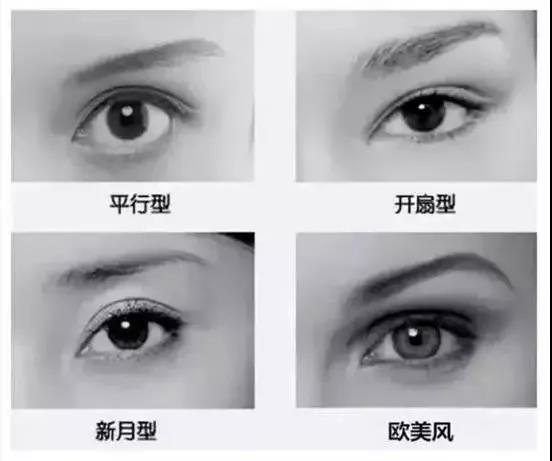 双眼皮手术