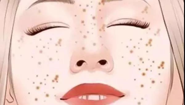 超皮秒祛斑