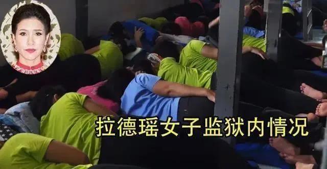 双眼皮手术