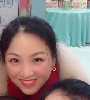 面部提升术
