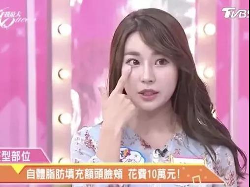 去眼袋手术