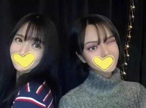 面部提升术