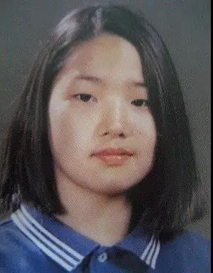 双眼皮手术