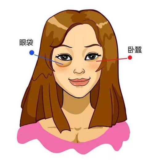 去眼袋手术