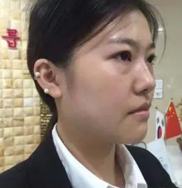 去眼袋手术