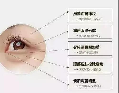 去眼袋手术