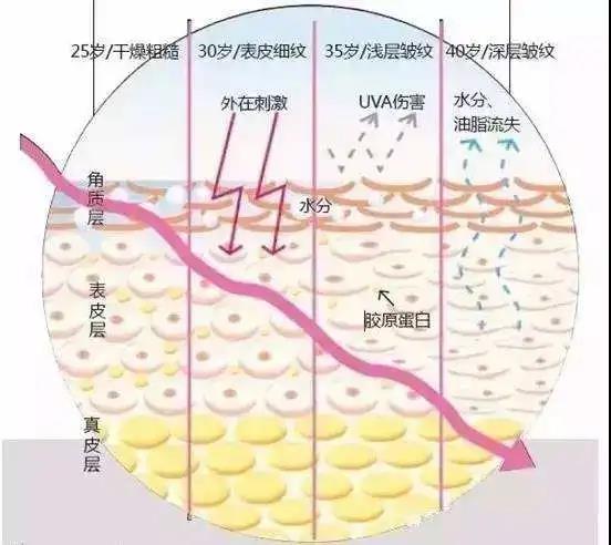 面部提升术