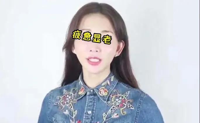 面部提升术