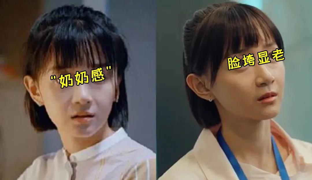 自体脂肪填充术