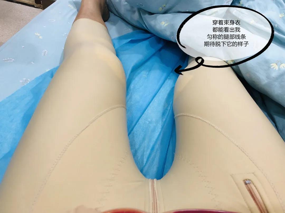 超声波减肥