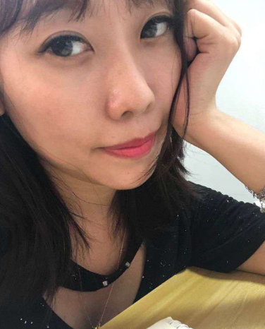 长效玻尿酸