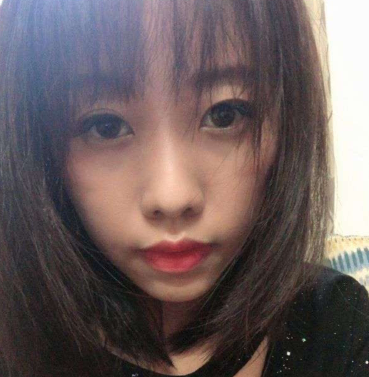 长效玻尿酸