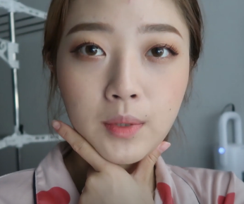 长效玻尿酸