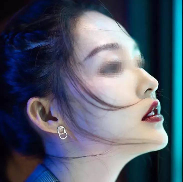 长效玻尿酸