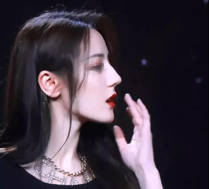 长效玻尿酸