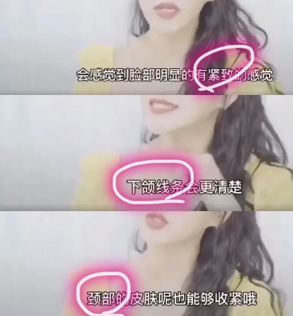 面部提升术