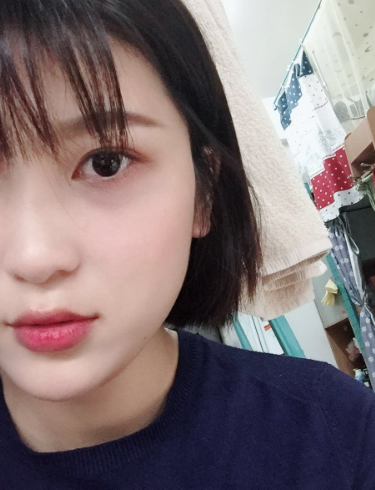去眼袋手术