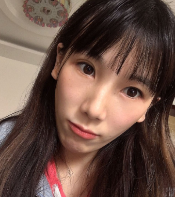 去眼袋手术