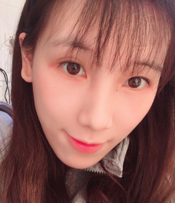 去眼袋手术