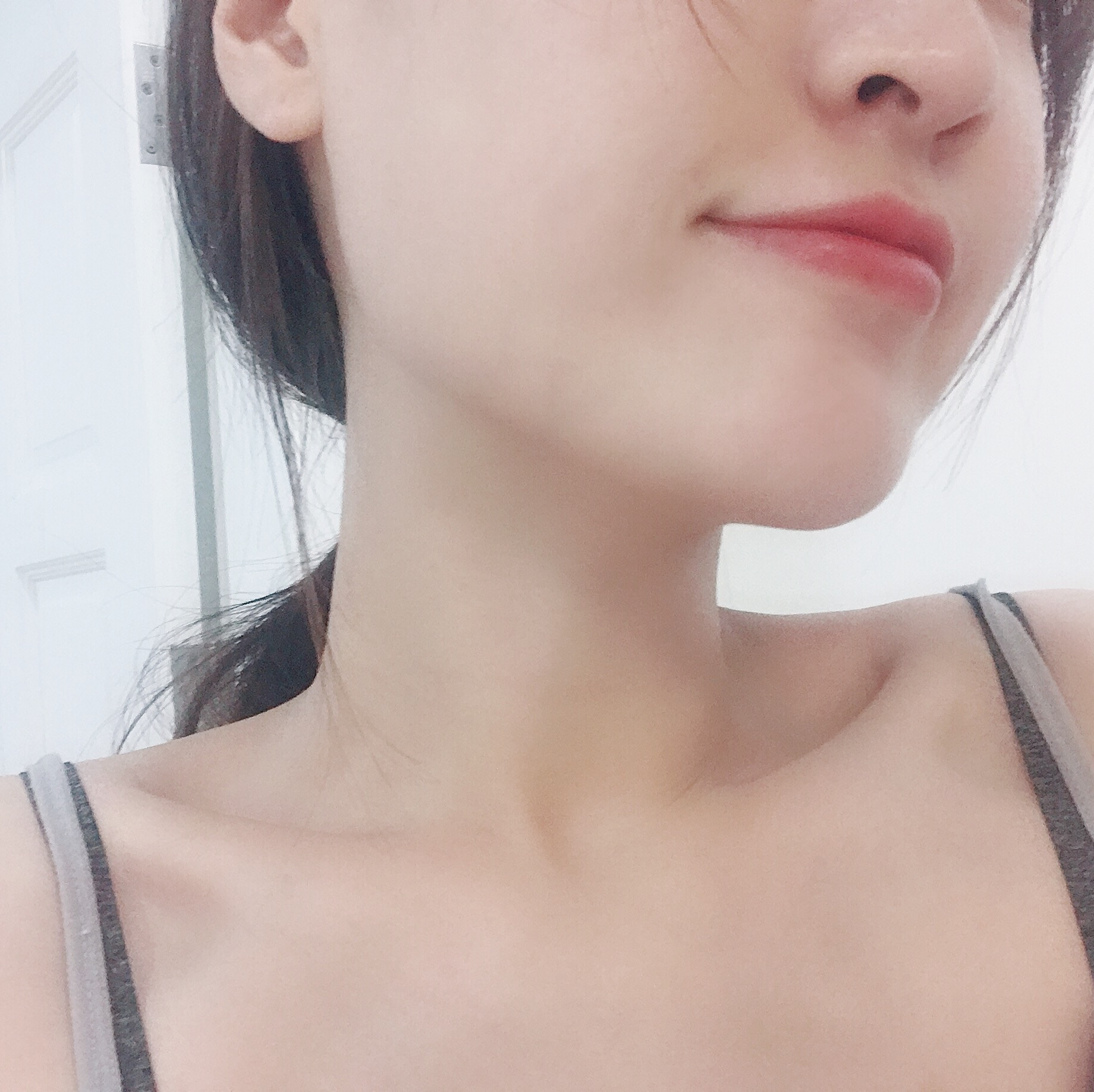 面部提升术