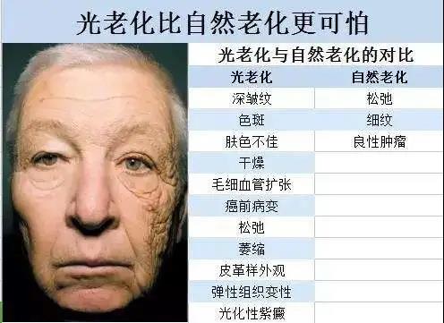 面部提升术