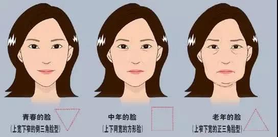 面部提升术