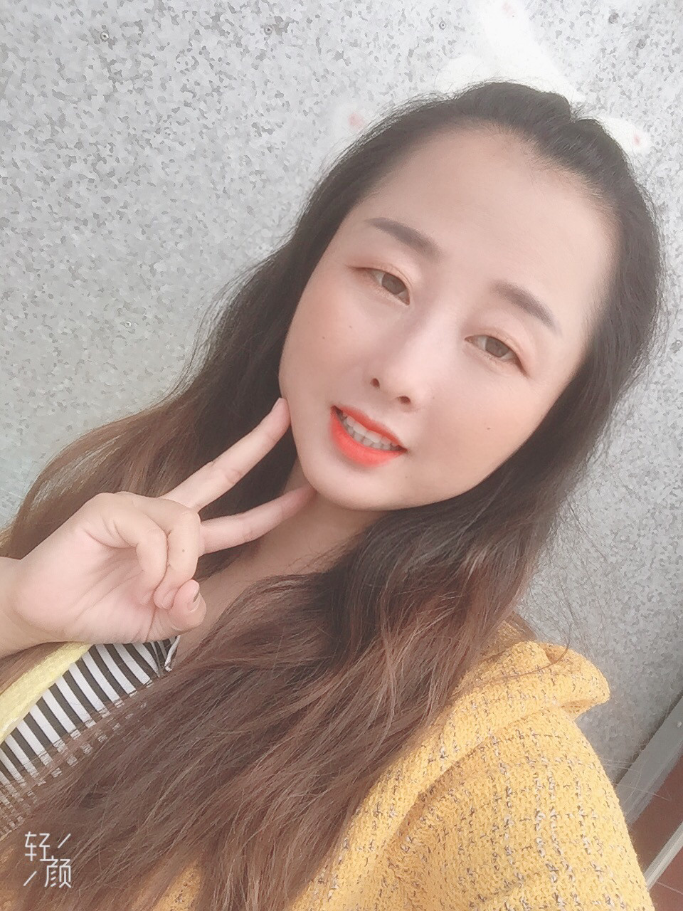 去眼袋手术