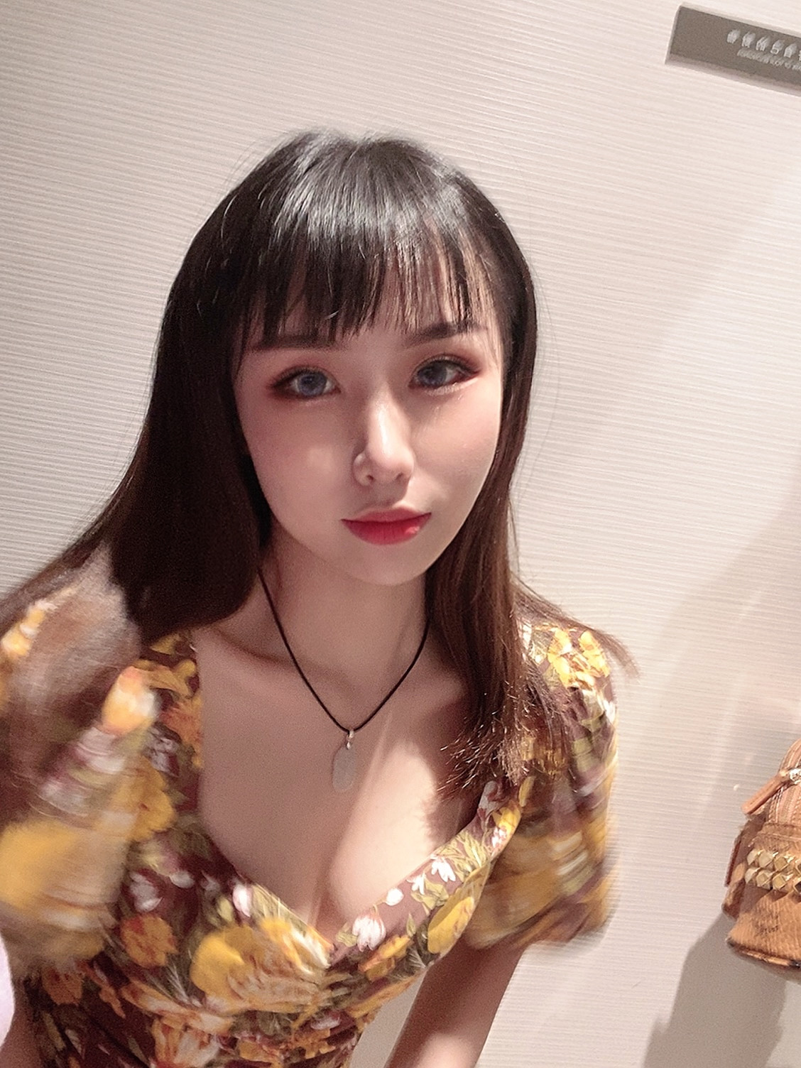 双眼皮手术