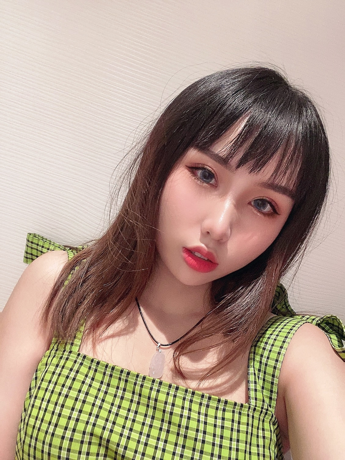 双眼皮手术