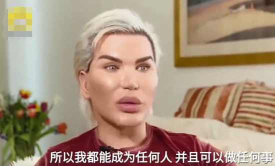 双眼皮手术