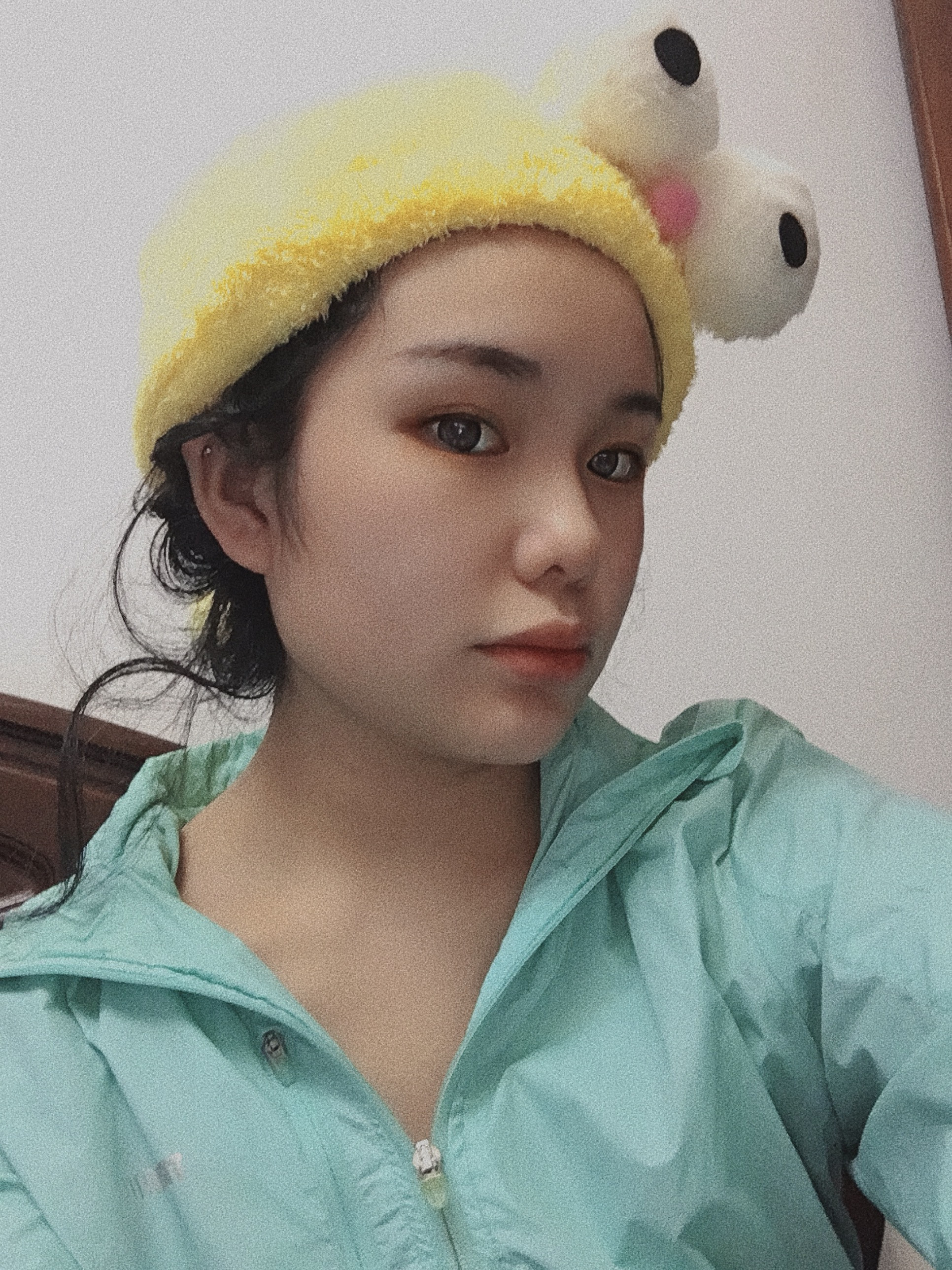 长效玻尿酸