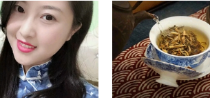 去眼袋手术