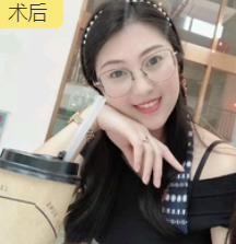 去眼袋手术